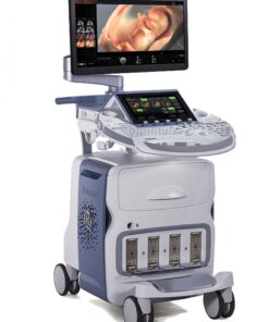 Máy siêu âm-Voluson-E6